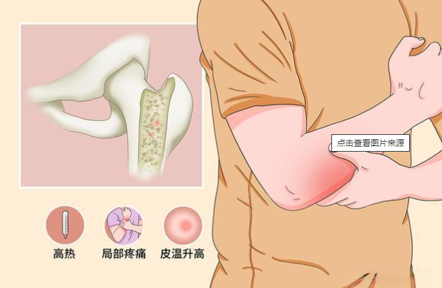 邵陽創(chuàng)傷骨科,邵陽風濕病區(qū),邵陽骨質(zhì)增生,邵陽關(guān)節(jié)病區(qū),邵陽頸椎病區(qū)