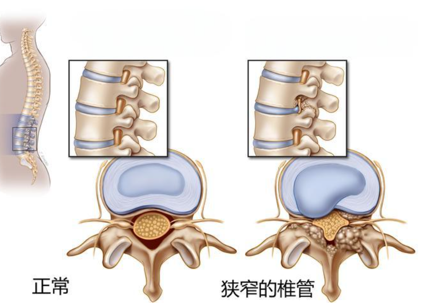 邵陽(yáng)創(chuàng)傷骨科,邵陽(yáng)風(fēng)濕病區(qū),邵陽(yáng)骨質(zhì)增生,邵陽(yáng)關(guān)節(jié)病區(qū),邵陽(yáng)頸椎病區(qū)